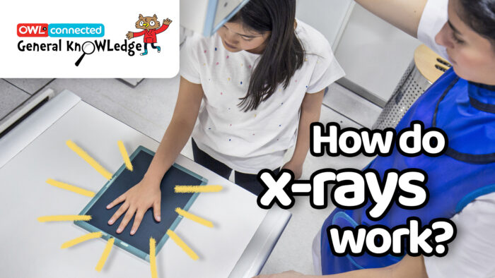 General KnOWLedge: How do X-rays work?